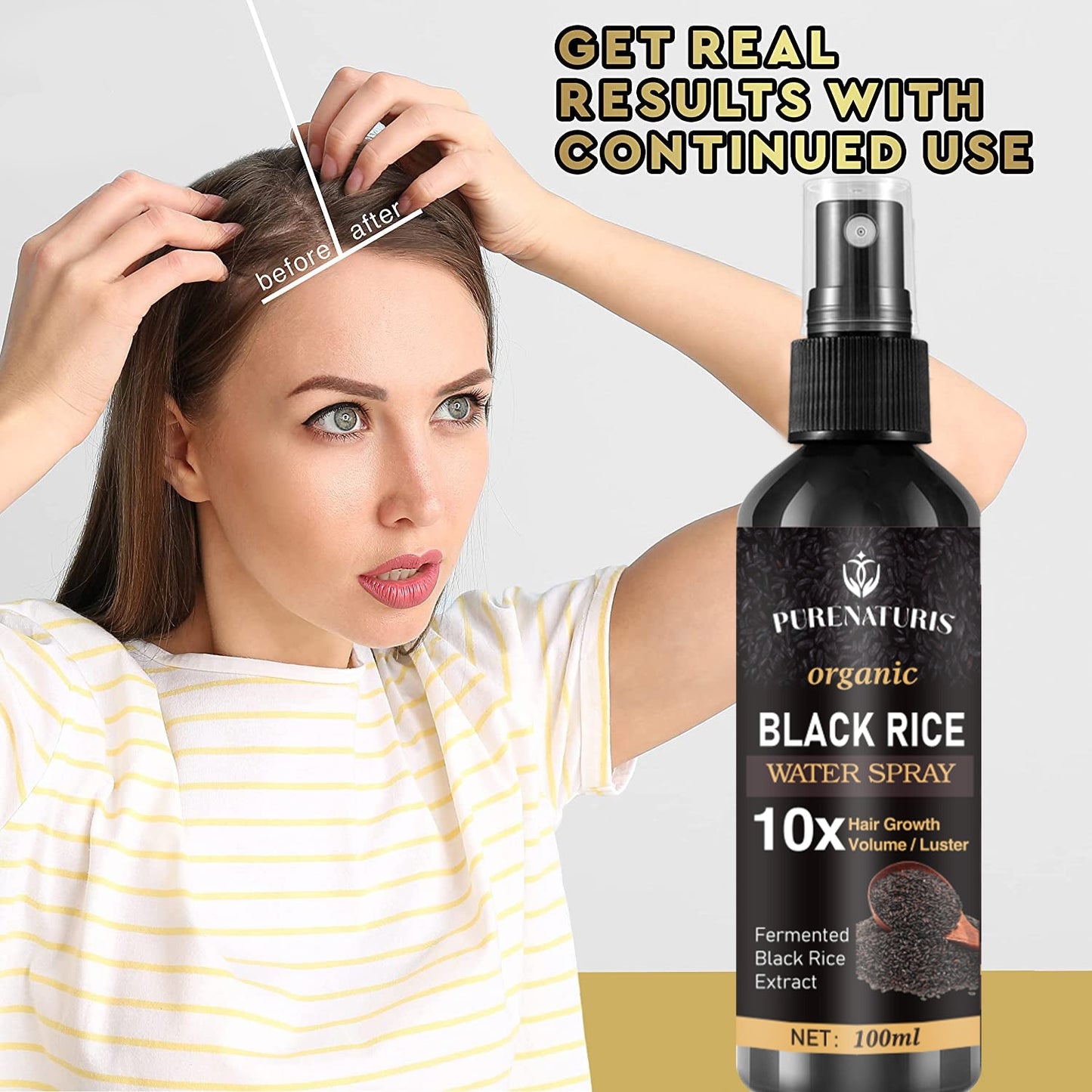 Natural Black Rice Water Hair Growth Spray For Women and Men with Castor Oil Ginger