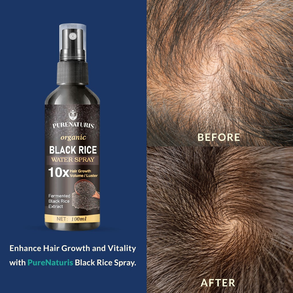 Natural Black Rice Water Hair Growth Spray For Women and Men with Castor Oil Ginger