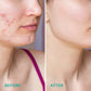 Before and after image of woman's face after using Green Tea Clay Mud Mask