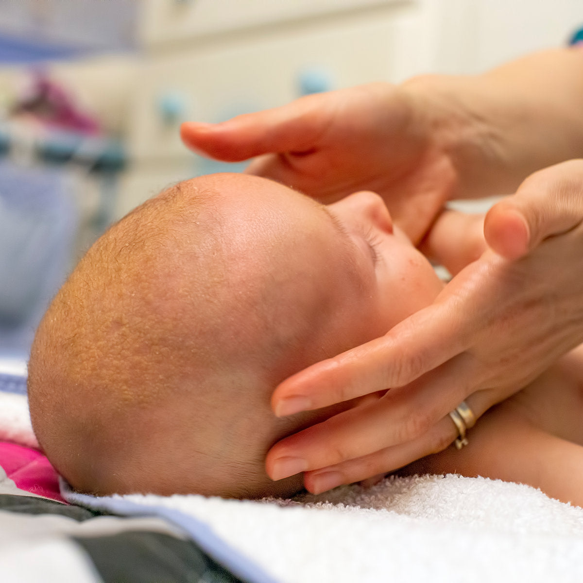 Baby with cradle cap